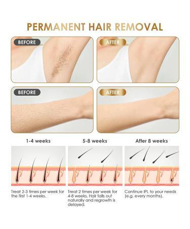 IPL Hair Removal Laser Device for Women and Men - Painless & Permanent At-Home Hair Remover - Safe for Armpits, Back, Arms, Legs, Bikini line, Full Body - White - Buy Online on GoSupps.com