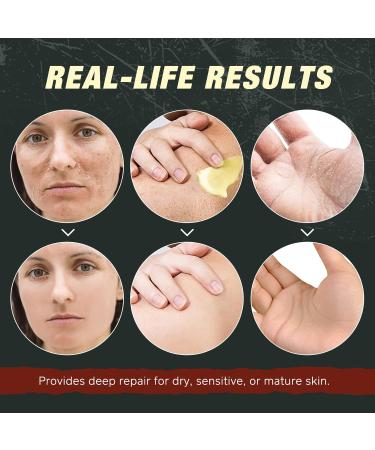 Yecuce Beef Tallow for Skin with Castor Oil and Frankincense 4.2 oz Grass-Fed Tallow Cream Face & Body Moisturizer for Dry Skin - Buy Online on GoSupps.com