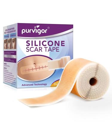Silicone Scar Tape for Scar Treatment  Advanced Scar Removal Sheets  Soften and Flattens Old Scars and New Scars Which Resulting from Surgery  Acne  Injury  Burns  C-Section and More (1.6 x 60 )