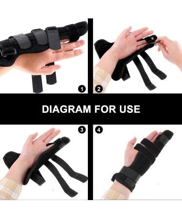 Adjustable DSL SQD Finger Rail for Ring & Small Fingers - Metacarpal Support for Boxer Fractures & Arthritis - Medium Hand Size - Buy Online on GoSupps.com