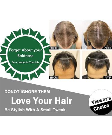 MTDBAOD Ginger Essential Oil 7 Days Natural Herbal Essence for Bald Ginger Anti Hair Loss Serum Ginger Germinal Serum Essence Oil - Buy Online on GoSupps.com