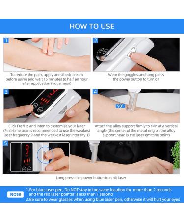 Stylo Picoseconde avec Cran LCD 9 Niveaux De Fr Quence + 4 Niveaux D'Intensit pour Liminer Les Tatouages Cicatrices Grains De Beaut Taches De Rousseur Et Taches Brunes Blue - Buy Online on GoSupps.com