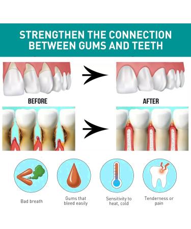 Toothache Relieving Spray Gum Repair Spray Oral Care Spray Toothache Pain Relief for Adult Gum Treatment Spray Rapid Relief Dental Spray Instant Teeth Treatment Relief Toothache Sprays Freshen Breath - Buy Online on GoSupps.com