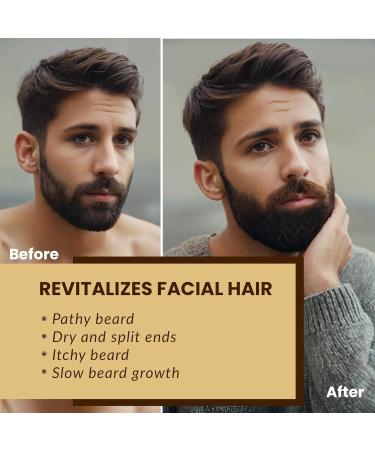 Beard Care Kit for Men | All-Natural Beard Growth Oil Balm & Serum | Ideal Grooming Gifts Gold - Buy Online on GoSupps.com