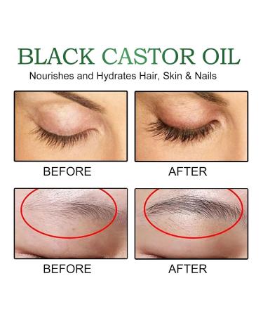 Premium Black Castor Oil - 100% Pure & Natural for Hair & Skin Wellness | International Shipping Available - Buy Online on GoSupps.com