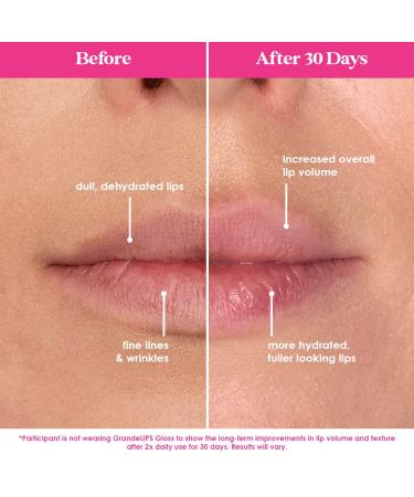 Grande Cosmetics Lip-Luggage Set: Ultimate Lip Care Kit - Buy Online on GoSupps.com