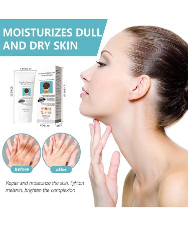 Mikabila (04) Acanthosis Nigricans Cream Face and Body Whitening Cream Skin Lightening Cream for Dark Skin Underarm Whitening Cream Effective for Armpit Knees Elbows & Knuckles - Buy Online on GoSupps.com