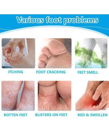  MagiSel Natural foot care cream with tea tree oil and herbal extracts natural formula for itchy and irritated skin tea tree oil cream for - Buy Online on GoSupps.com