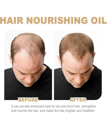 Organic Hair Oil Hair Growth Oil 60ml Nourishing Natural Argan Oil Non Greasy Hair GrowthSe Rum With Natural Ingredient Strengthening Hair Oil For Damaged Hair Daily Use Scalp Moisturizing - Buy Online on GoSupps.com
