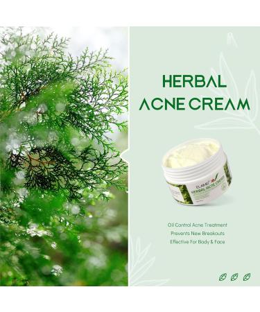 Herbal Acne Cream Anti Acne Face Cream Spot Cream Acne Treatment for Face Face Moisturiser with Plant Extract Spot Cream for Fade Acne Mark & Calm Acne Redness for All Skin Types - Buy Online on GoSupps.com