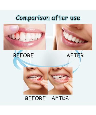 Spray Soulager les Gencives D garnies Spray de Soulagement des Gencives Spray Contre les Maux de Dents 30ML 1PC - Buy Online on GoSupps.com
