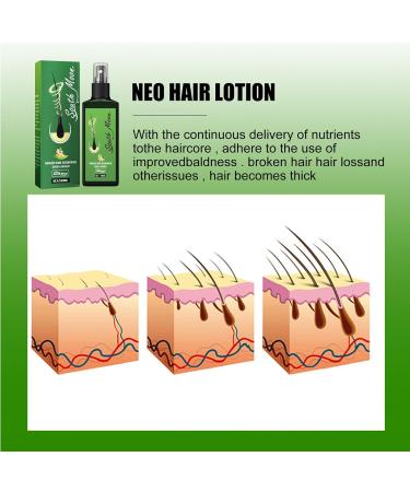 Hair Growth Serum & Lotion for Men & Women - Nourishing Hair Regrowth Treatment & Care - Buy Online on GoSupps.com