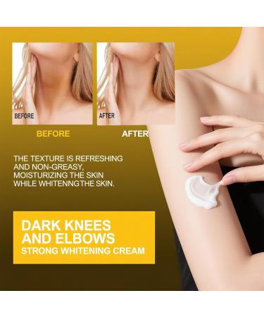 Dark Knuckle Remover Underarm Cream Body Moisturizer Lotion Toe Knuckles Removal Remover Corrector for Armpit Knees Elbow Inner Thigh Neck Private Part Intimate Skin Cream 4.21floz/120g - Buy Online on GoSupps.com