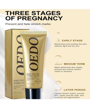 Natural Rose Stretch Mark Cream for Pregnancy - Effective Scar Removal & Prevention | 40g Body Moisturizer - Buy Online on GoSupps.com