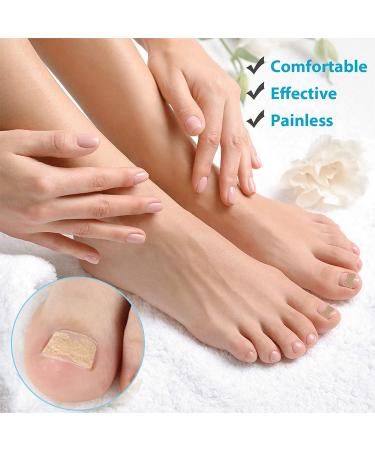 Fitmedify Toenail Correction Patch - 60 Pcs for Ingrown Toenail Prevention - Buy Online on GoSupps.com