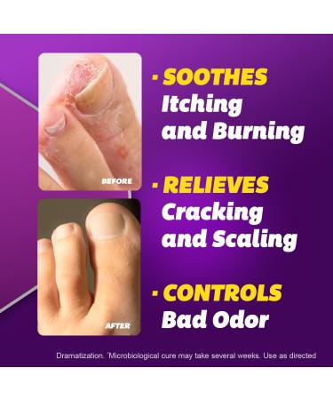 SILKA Anti-Fungal Cream 1 Oz - Clinical Foot Treatment Fluid - Buy Online on GoSupps.com