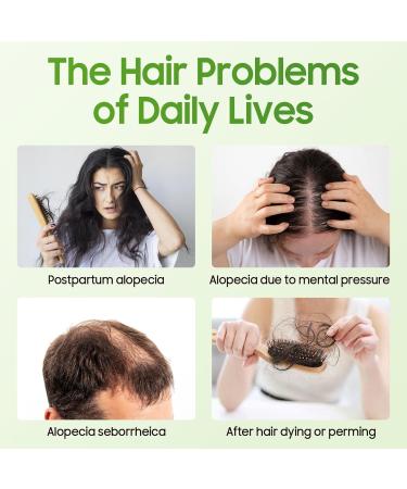100% Pure Natural Rosemary Oil - Multipurpose Hair Oil for Growth Nourishing Scalp & Strengthening Hair - Buy Online on GoSupps.com