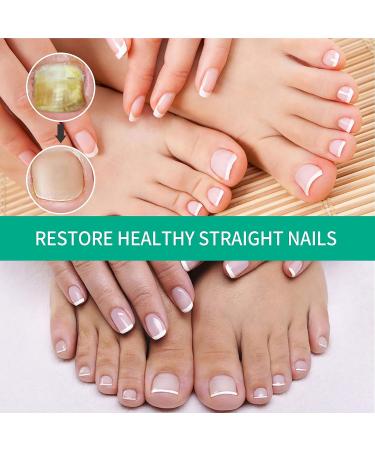 Kerassentials Toenail Treatment - Extra Strength for Damaged & Discolored Nails (3pcs) - Buy Online on GoSupps.com