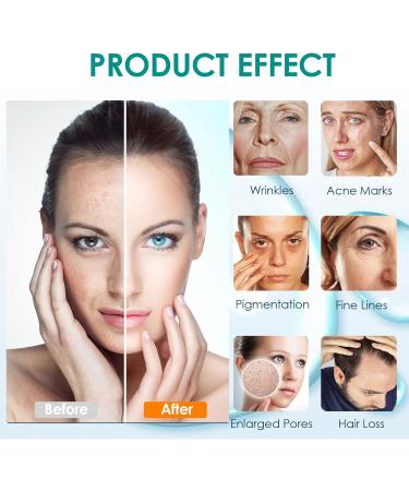 Drpen Factory Drpen Ultima M8 24pin replacement cartridges original Dr Pen Replacement Part for Microneedling Pen M8 Model Authentic Disposable Replacement Cartridges 24 PIN 10 pcs 24 Pins 10 pcs - Buy Online on GoSupps.com