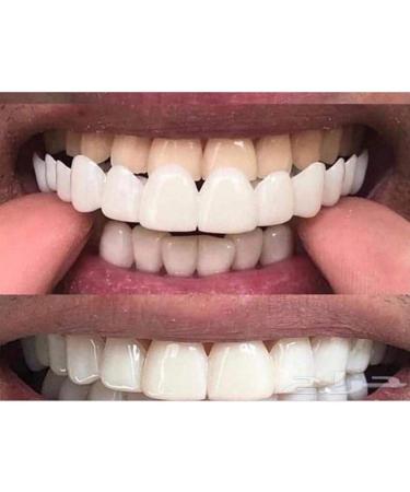 XLBHSH Fake Teeth Veneers - Instant Snap-On Cosmetic Smile Cover | 3 Pairs for Perfect Teeth | Temporary Brackets for Upper & Lower Teeth - Buy Online on GoSupps.com