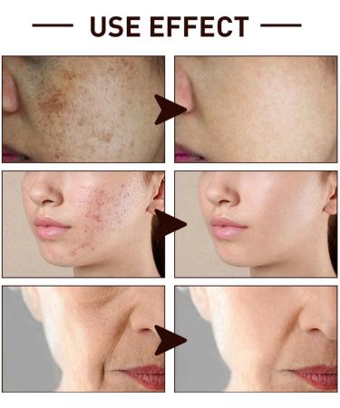 Gla-Mory Micros-Infusions System for Face Gla-Mory Micro-Infusions System for Lips Hyaluronic Acid Serum for Face Smooth Skin Facial Serum Gla-Mory Facial System Hydrating Serum for All Skin 10ml - Buy Online on GoSupps.com