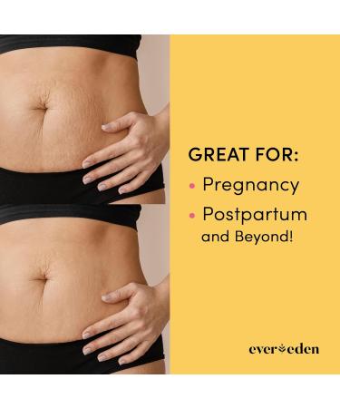 Evereden Nourishing Stretch Mark Cream | Clean & Unscented Pregnancy Skincare | 1.7 fl oz - Prevent Stretch Marks Internationally - Buy Online on GoSupps.com