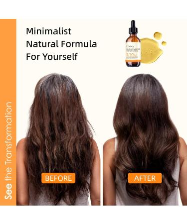 Organic Castor Oil & Rosemary Oil for Hair Growth | 2 Fl Oz | Vegan Scalp Treatment & Moisturizer for All Hair Types - Buy Online on GoSupps.com