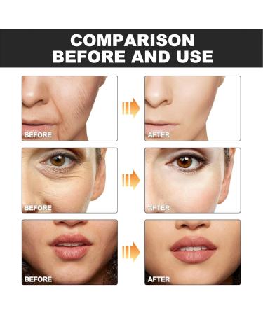 Fyearfly Melting collagen film 20 pieces cheek collagen films longlasting hydration soluble collagen films skin firming pure collagen films for reducing wrinkles - Buy Online on GoSupps.com