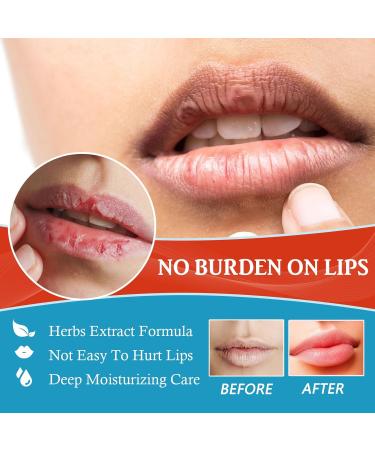 Healing Lip Balm for Dry Cracked Lips | Natural & Organic Cheilitis Treatment for Men Women & Children | Dermatologist Recommended All-Day Moisture - Buy Online on GoSupps.com