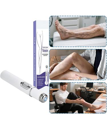 Spider Vein Remover | Non-Invasive Mole And Wart Removal Pen Fast Acting Care For Salon Home Postpartum Post Exercise Travel Camping Night Obese People Face Body Suitable Fo - Buy Online on GoSupps.com