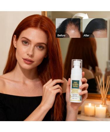  szaluyk hair growth spray scalp regrowth treatment moisturizing care conditioner conditioner oil to support follicles daily scalp refresh for a scalp - Buy Online on GoSupps.com