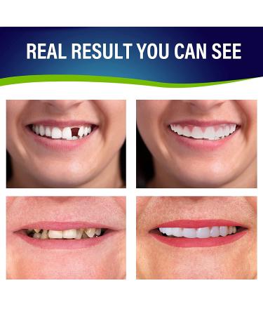 2 PCS Fake Teeth Dentures for Upper and Lower Jaw - Natural & Comfortable Smile Solution - Buy Online on GoSupps.com