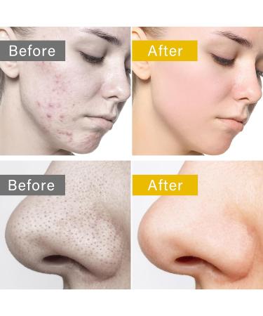 Vita C Facial Pads - Anti-Aging Skin Care Exfoliating & Pore-Reducing Face Pads 70 Sheets - International Shipping Available - Buy Online on GoSupps.com