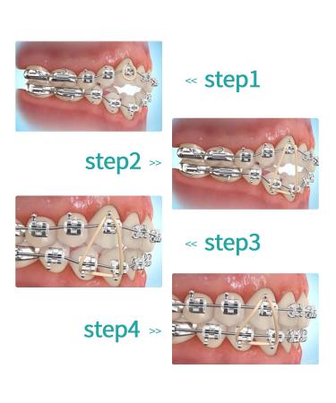 LVCHEN Penguin Rubber Bands for Braces - 500pcs 3.5oz Heavy Traction Bands - 5/16 inch (100pcs/pack) - Buy Online on GoSupps.com