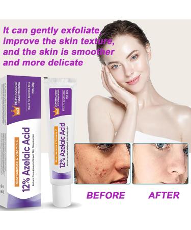 Azelaic Acid 12% Facial Serum Azelaic Acid Serum Face Cream Skin Care Beauty with Niacinamide & Vitamin C Removes Acne Redness Fade Dark Spots Correcting 20G (1) - Buy Online on GoSupps.com
