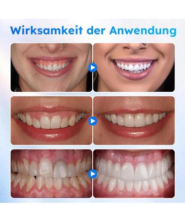 Oral Gel for Gum Treatment Gum Gel Gum Treatment Gel Gum Protection Therapy Gel for Gum Restoration and Teeth Whitening (8PC) - Buy Online on GoSupps.com