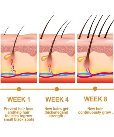 QDHGCFOC Rice Water Hair Oil Hair Serum Natural Rice Essence Nourishing Hair Serum Natural Rice Milk Serum Strengthens Scalp Improves Hair Condition - Buy Online on GoSupps.com