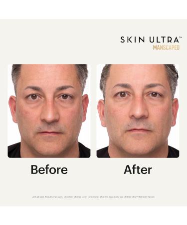 MANSCAPED Skin Ultra Retinoid Serum - Dual Retinoid Age-Defying Formula with Squalane Ceramides & Hyaluronic Acid to help Reduce Appearance of Fine Lines Wrinkles & Dark Spots 1 fl oz. - Buy Online on GoSupps.com