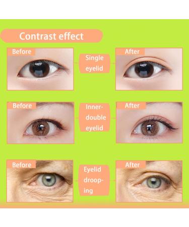 Akliocss 6MM Invisible Eyelid Tape Instant Eye Lift Strips One-sided Sticky Eyelid Sticker - for Hooded Droopy Uneven or Mono-eyelids Waterproof 6MM 280Pcs Pink - Buy Online on GoSupps.com