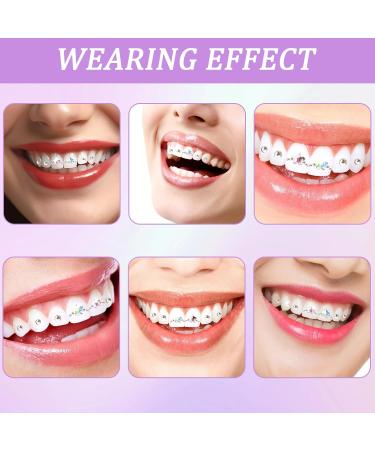 Complete Tooth Jewelry Gem Kit | Tooth Gem Set with Adhesive & Star Edelstones | Create Stunning Tooth Accessories - Buy Online on GoSupps.com