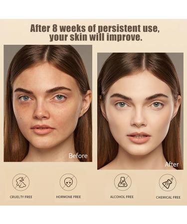 Dark Spot Correcting Glow Serum - Dark Spot Remover for Face - Nicotinamide Serum for Fade Acne Marks - Face Serum to Even Skin Tone & Shrink Pores - Face Moisturiser Skin Care for All Skin Types - Buy Online on GoSupps.com