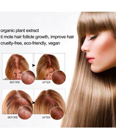 5 Ginger Hair Regrowth Shampoo | Thick Moisturizing Shampoo for Hair Growth Natural Organic Ginger Shampoo Woyufen - Buy Online on GoSupps.com