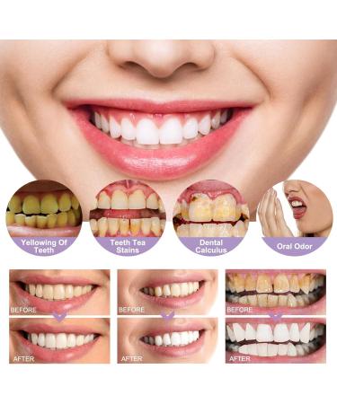 2 PCs Glostik Tooth Gloss - Instant Whitening & Glossy Smile | Tooth Whitening Pen for Tea Stains | Fast Results - Buy Online on GoSupps.com