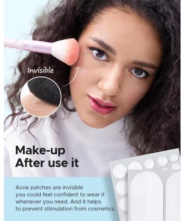 Acne Pimple Patches - 80 Hydrocolloid Bandages in 5 Sizes | Tea Tree & Calendula Oil Spot Treatment for Face Chin & Body - Buy Online on GoSupps.com
