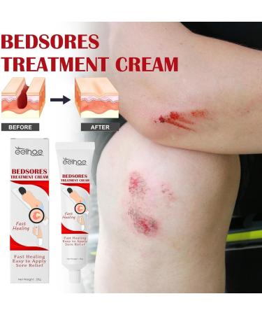 5 Bedsore Cream Bed So re Cream Fast Acting Pressure Sor e Relief Cream Bedsore Wound Care Cream Fast Wound Healing Gel Soothing Relief Of Bed Soress 20g Bedsore Ointment Bed Soress Care Crea - Buy Online on GoSupps.com
