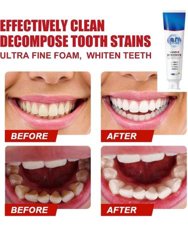 Probiotic Rapid Whitening Toothpaste | Smile Doctor SP-4 | Fresh Breath & Ultra Whitening (2PCs) - International Shipping Available - Buy Online on GoSupps.com