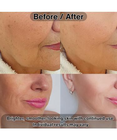 ELT Vita Youth Vitamin C Face Serum 1.69fl.oz.(50ml) - Ferulic Acid Beta-Glucan - Skin Brightening Anti-Aging Dark Spot Remover - Korean Skincare (Pack of 1) 1.68 Fl Oz (Pack of 1) - Buy Online on GoSupps.com