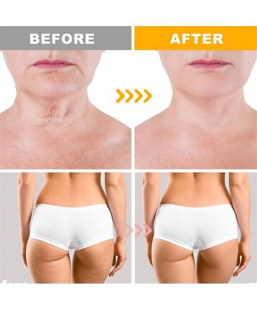 Manuka Honey Face Cream Honey Face Moisturiser Soothes Hydrates Increases Skin Elasticity 2 in 1 Face & Body Moisturiser Body Cream for Face Neck Body 100ml - Buy Online on GoSupps.com