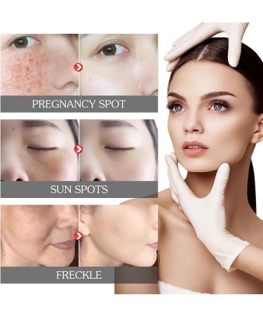 Cremas Para Las Manchas de La Cara Crema Blanqueadora Para Pecas Crema de Eliminaci n de Manchas Oscuras Cream for Dark Spots Crema Aclaradora Para Piel Manchas En Cara (3pcs) - Buy Online on GoSupps.com