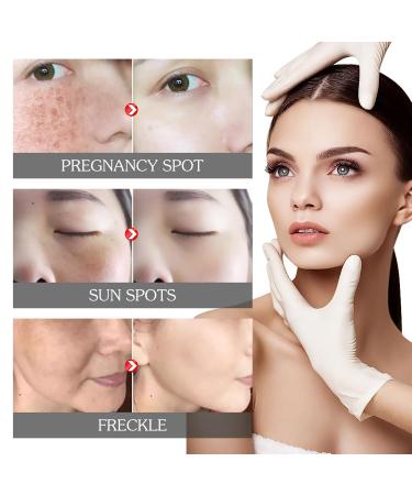 BEROZA Cremas Para Las Manchas de La Cara 30ml Crema Para Manchas Oscuras En La Cara Vitamin C&E Face Moisturizer Cream Adecuado para varias reas como cara axilas cuello zona privada - Buy Online on GoSupps.com